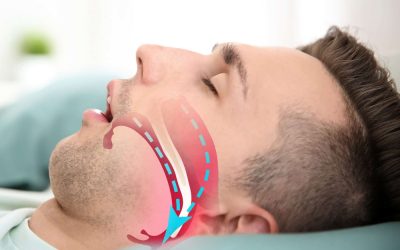 How Hypnotherapy Can Help with Sleep Apnea…